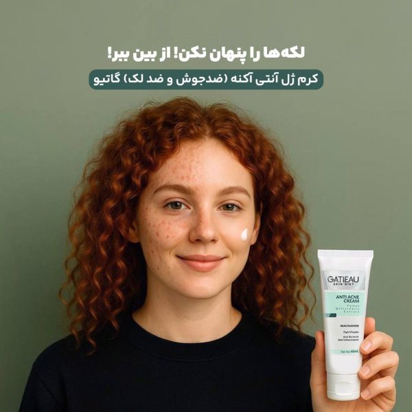 𓂃 🫧🌿 کرم‌ژل آنتی‌آکنه گاتیو | ضدجوش و ضدلک 🌿🫧 𓂃